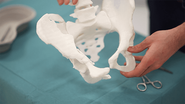 3D Printing in Medicine